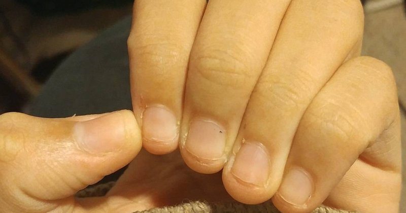 Modelos de IA falham em usar imagens em exames médicos poloneses